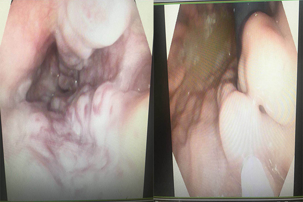 Ժ(ni)ƳɹӲw(ni)r(sh)ը