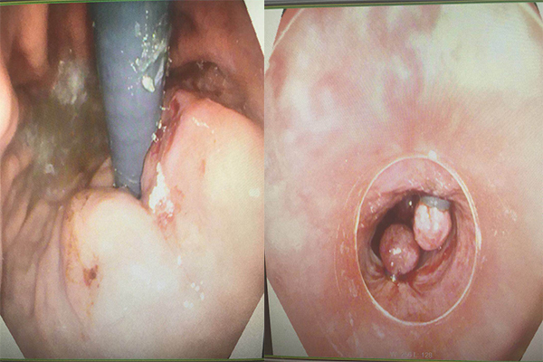 Ժ(ni)ƳɹӲw(ni)r(sh)ը