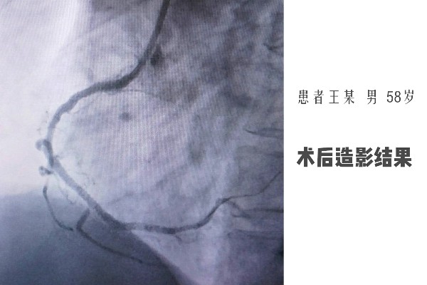 �g(sh��)����Ӱ�Y(ji��)��