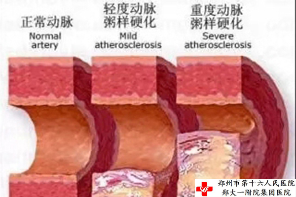 ��(d��ng)�}����Ӳ���D