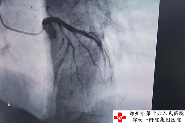 �ί�ǰ-ǰ��֧���жνӽ�85%�]��