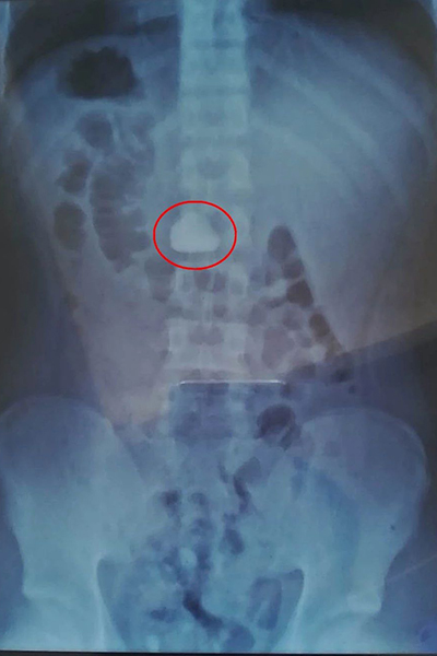 �tȦ��(n��i)��X��͸ҕ��θ��(n��i)��ʯ�^