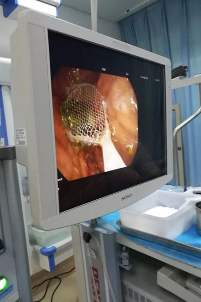 θ�װl(f��)�F(xi��n)ʯ�^�󣬜ʂ�W(w��ng)�@��ȡ