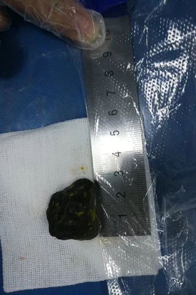 ��(n��i)�R��ȡ������θ��(n��i)ʯ�^