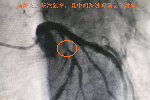 �ί�ǰ�ڠ���Ӱ�@ʾ