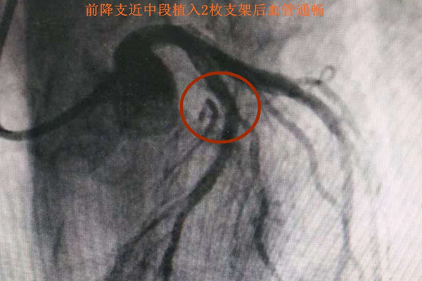 �ί���ڠ���Ӱ�@ʾ