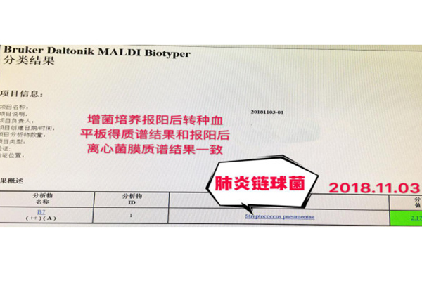 15�q�к���Σ��Ժ�Fꠅf(xi��)����(chu��ng)�¼��g���������r����