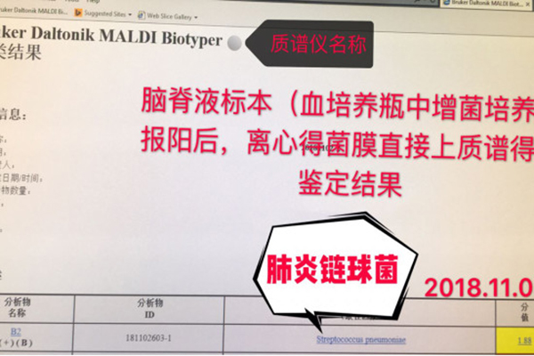 15�q�к���Σ��Ժ�Fꠅf(xi��)����(chu��ng)�¼��g���������r����