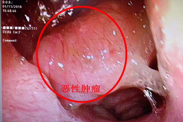 ��ӱ��ʺ��R����ӱ��ʺ����b�e�Ī��T�ؼ�