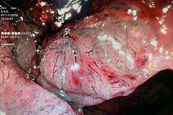 ��ӱ��ʺ��R����ӱ��ʺ����b�e�Ī��T�ؼ�