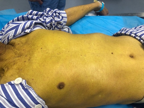 ERCP΢��(chu��ng)�ί������^ͻ����׌�����D(zhu��n)Σ�鰲