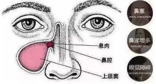 ϢЩYF(xin)