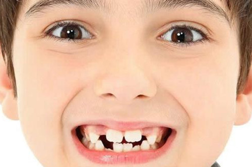 ͯXCSrCʲôr