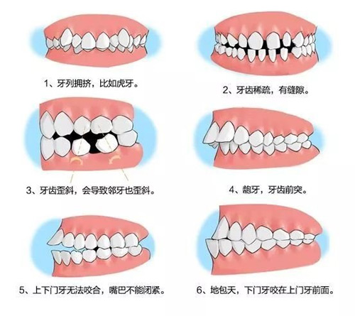 ͯXCSrCʲôr