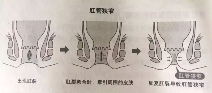 ʲôǸѣʲôԭ