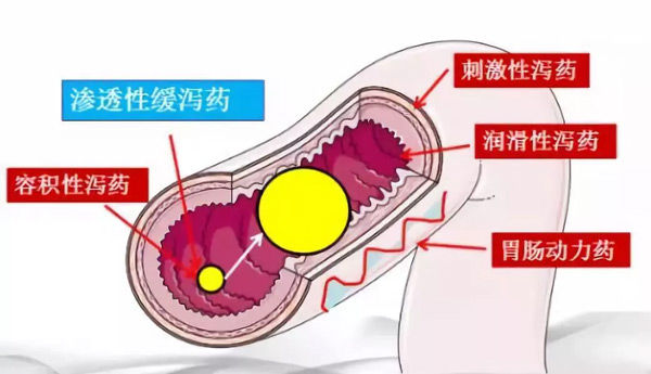 治便秘用瀉藥?你知道危害有多大嗎? 治便秘用瀉藥?你知道危害有多大嗎?