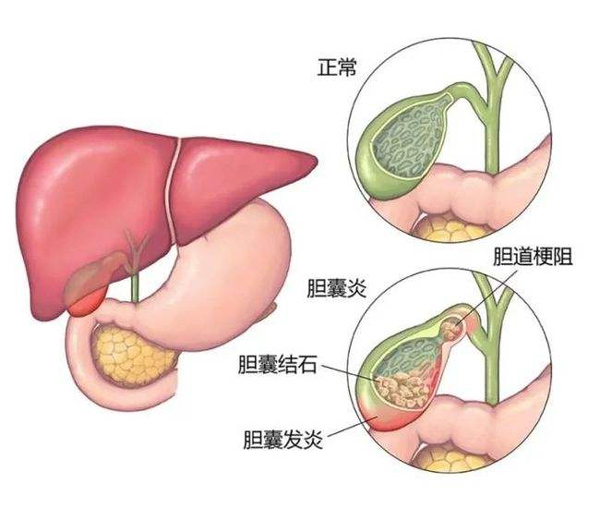 體檢報告你會看嗎?這些指標(biāo)異常未必就是病 體檢報告你會看嗎?這些指標(biāo)異常未必就是病