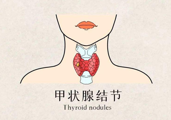 體檢報告你會看嗎?這些指標(biāo)異常未必就是病 體檢報告你會看嗎?這些指標(biāo)異常未必就是病