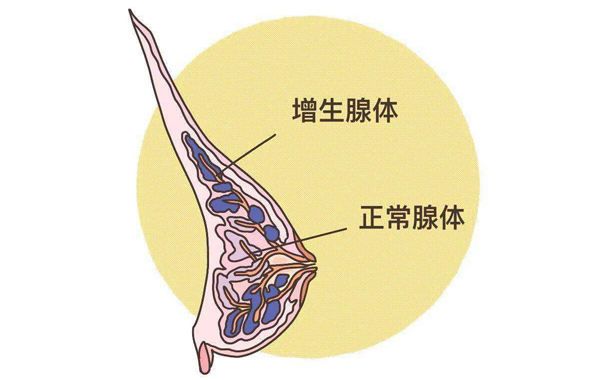體檢報告你會看嗎?這些指標(biāo)異常未必就是病 體檢報告你會看嗎?這些指標(biāo)異常未必就是病