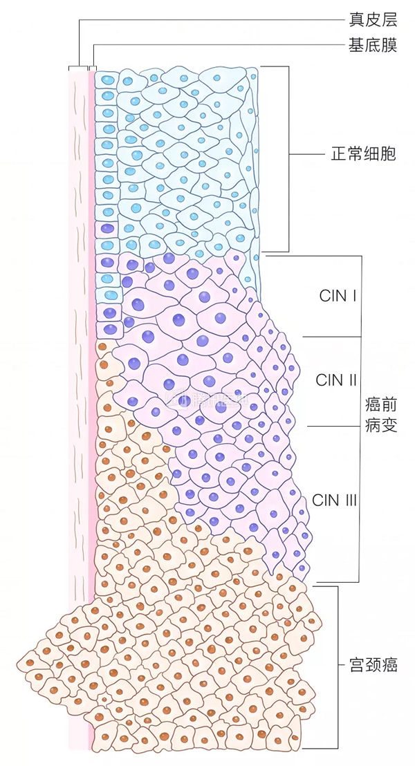 “活檢”是什么?怎么做? “活檢”是什么?怎么做?