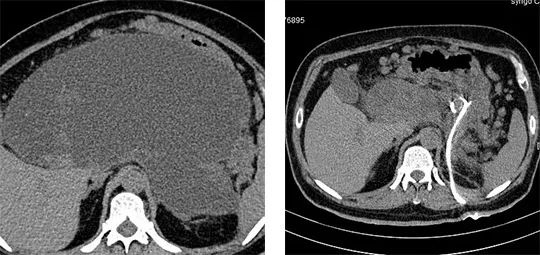 Ժ΢(chung)g(sh)pίټ[