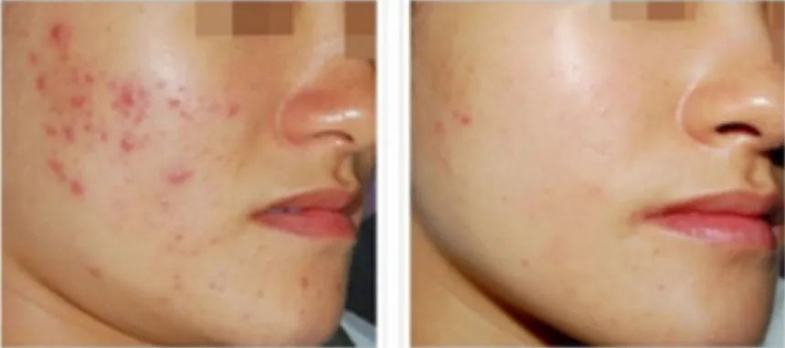 wô(i)Ҫע@c(din)~