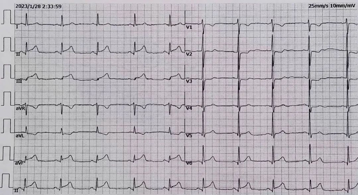 ꖳt(y)Ժʹڴ(ji)Bm(x)ɹ΃Ĺ