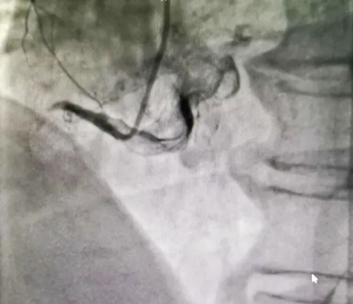 ꖳt(y)Ժʹڴ(ji)Bm(x)ɹ΃Ĺ