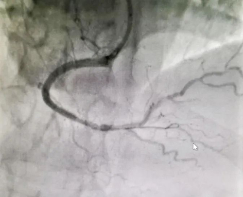 ꖳt(y)Ժʹڴ(ji)Bm(x)ɹ΃Ĺ