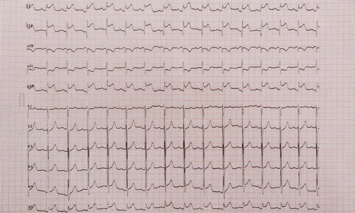 ꖳt(y)Ժʹڴ(ji)Bm(x)ɹ΃Ĺ