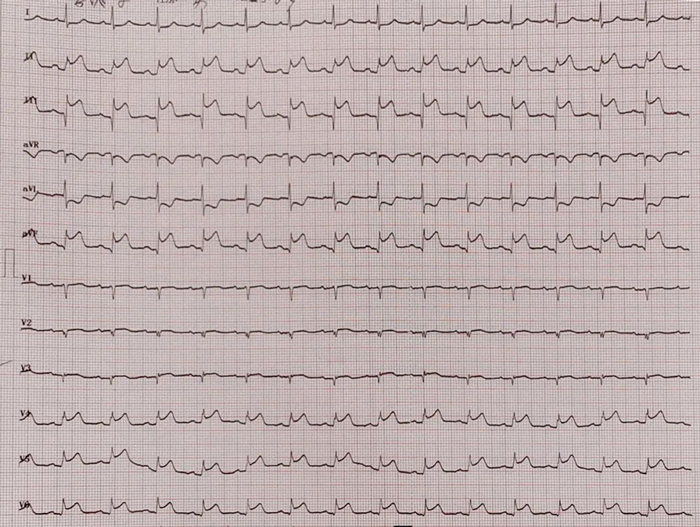 ꖳt(y)Ժʹڴ(ji)Bm(x)ɹ΃Ĺ