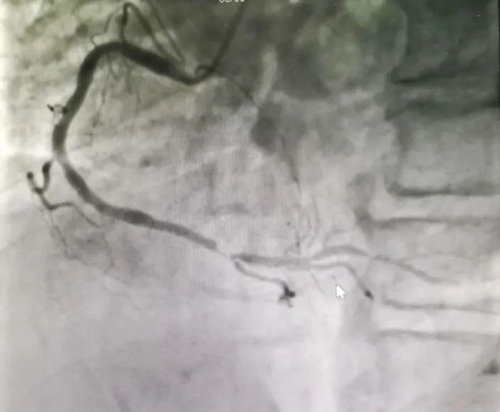 ꖳt(y)Ժʹڴ(ji)Bm(x)ɹ΃Ĺ