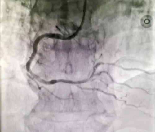 ꖳt(y)Ժʹڴ(ji)Bm(x)ɹ΃Ĺ