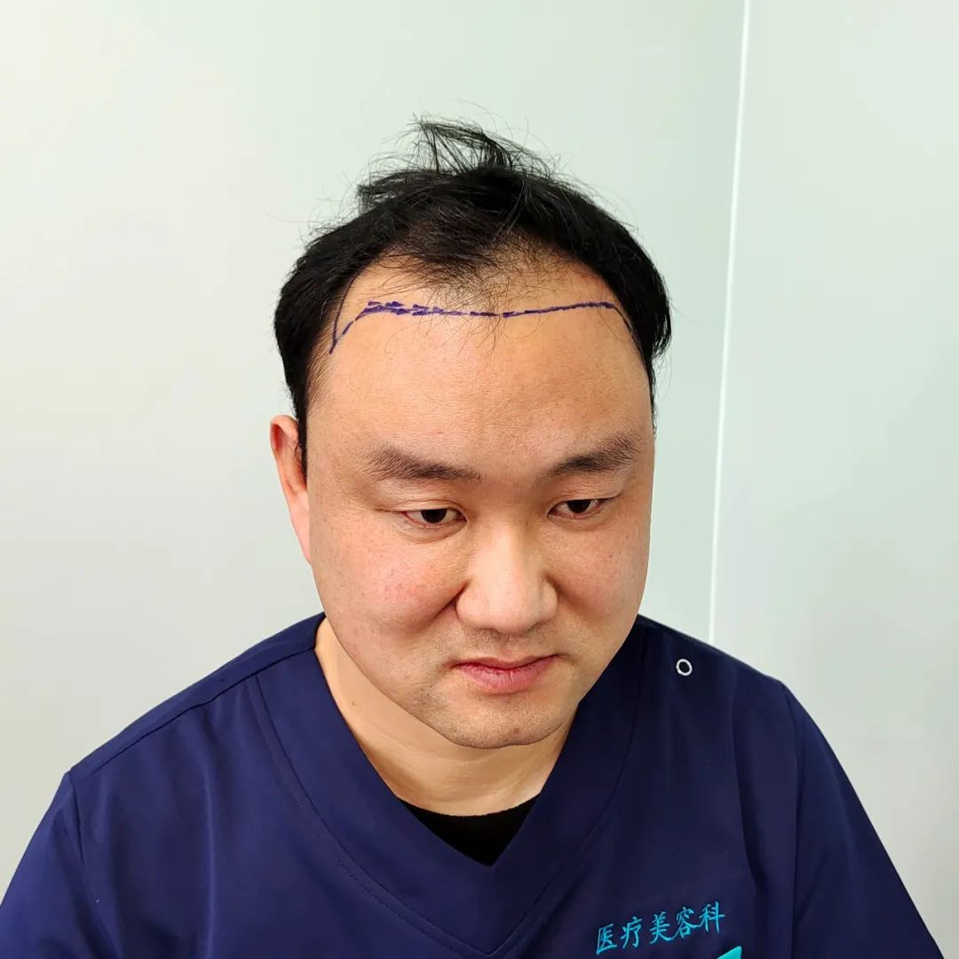 һꡰֲڴ׃(dng)r(sh)