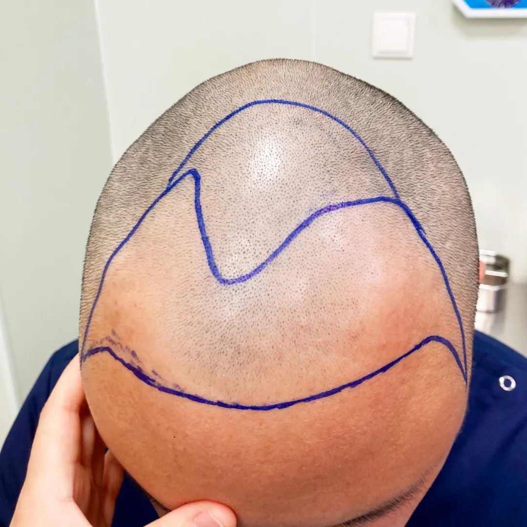 һꡰֲڴ׃(dng)r(sh)