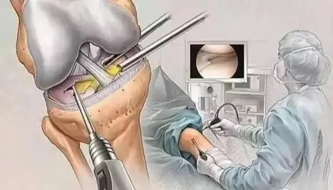 ꖳt(y)ԺǿƳ_չϥP(gun)(ji)R΢(chung)g(sh)