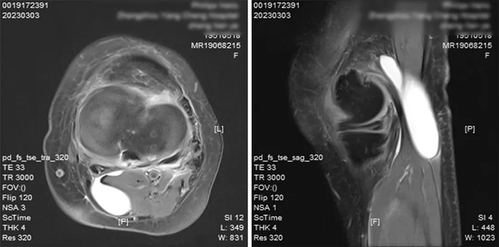 ꖳt(y)ԺǿƳ_չϥP(gun)(ji)R΢(chung)g(sh)