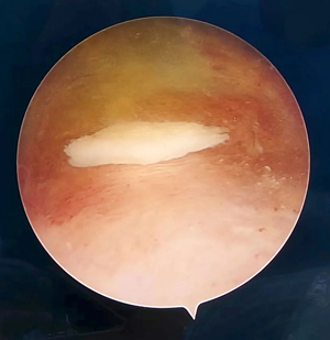 ꖳt(y)ԺǿƳ_չϥP(gun)(ji)R΢(chung)g(sh)