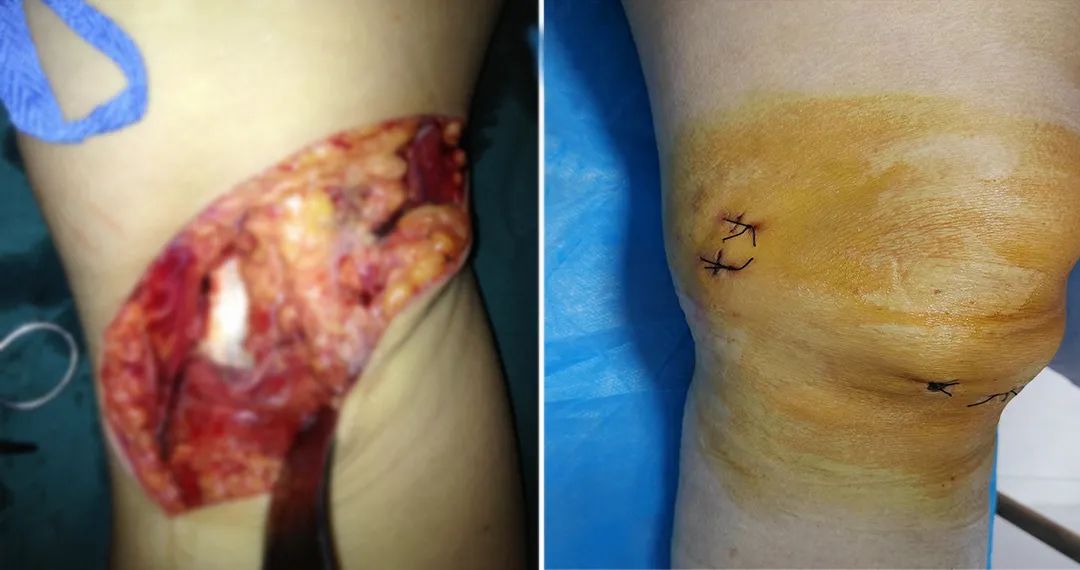 ꖳt(y)ԺǿƳ_չϥP(gun)(ji)R΢(chung)g(sh)