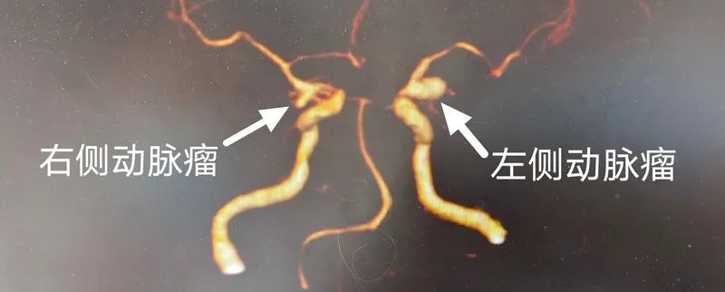 ΣC(j)ķҡϾժX(ni)r(sh)ը