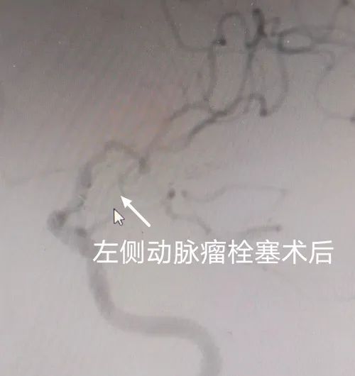 ΣC(j)ķҡϾժX(ni)r(sh)ը