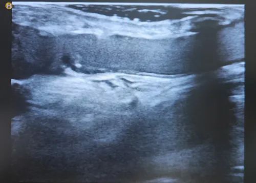 Ҋƽҡٴδͨ......