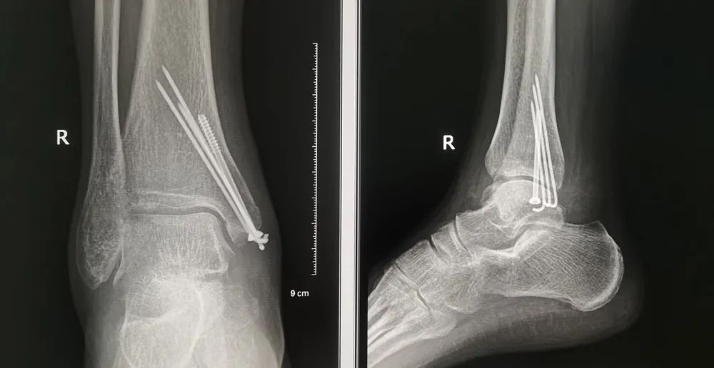 @Ӱz؂ġʡġؼһ