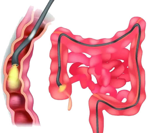 θ(li)r(sh)oġ@(xing)z顰~