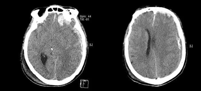 f64qǰǸĸo64qԺゃo