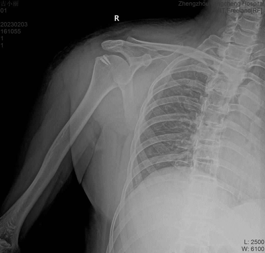 ʹe׌ס偡F(xin)@NrһҪ......