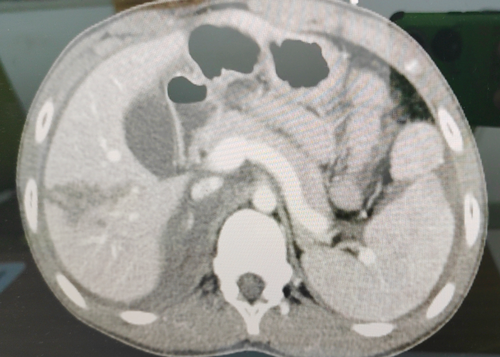 17q܇}t(y)ġ(jng)򞡱