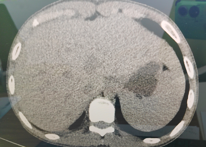 17q܇}t(y)ġ(jng)򞡱