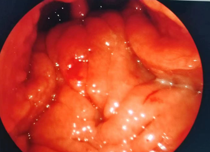 ˯X(ju)ǷҲСޡ