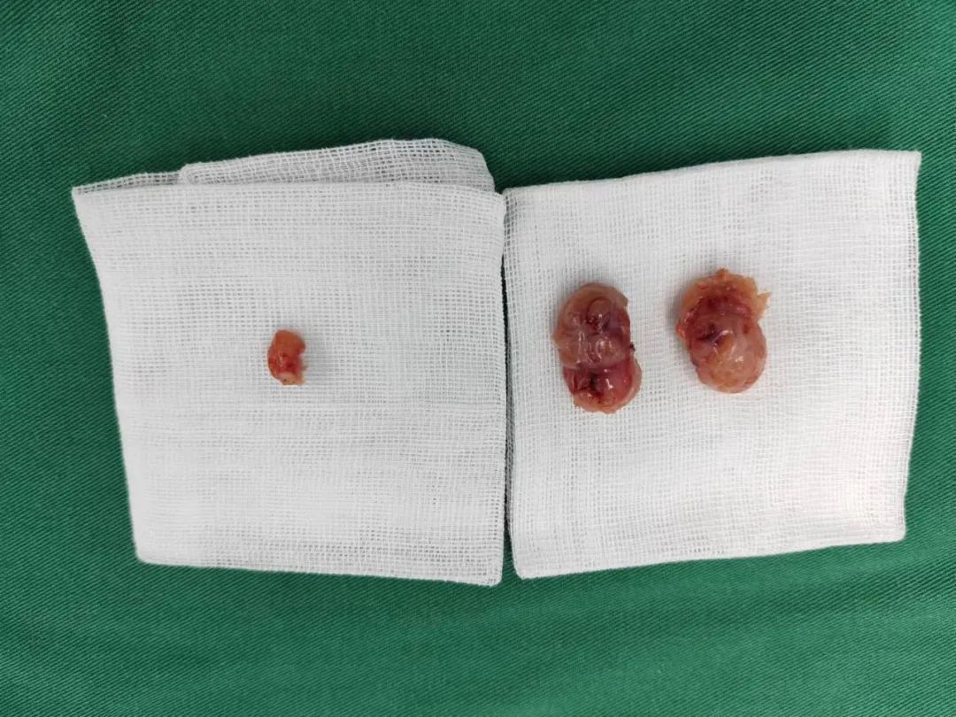 ˯X(ju)ǷҲСޡ